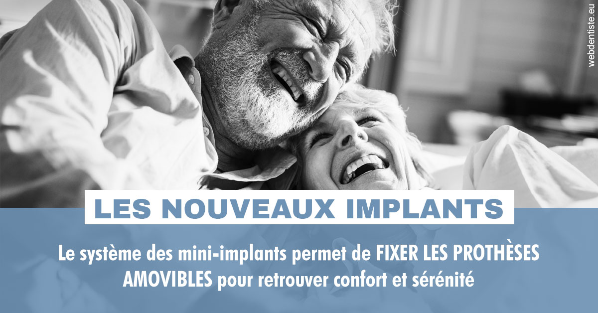 https://www.dentistes-lafontaine-ducrocq.fr/Les nouveaux implants 2