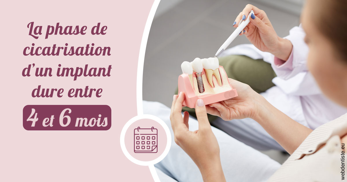 https://www.dentistes-lafontaine-ducrocq.fr/Cicatrisation implant 2