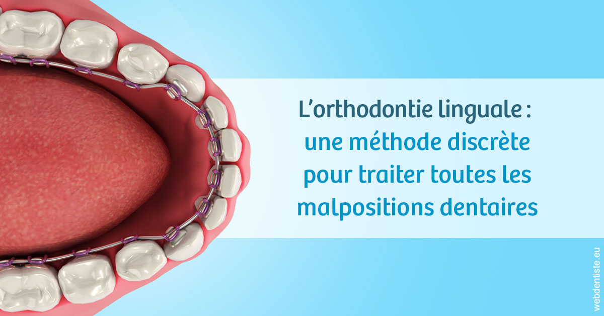 https://www.dentistes-lafontaine-ducrocq.fr/L'orthodontie linguale 1
