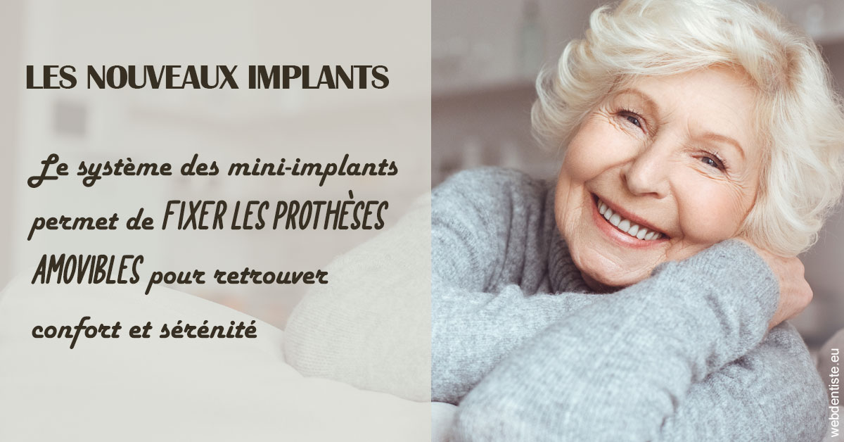 https://www.dentistes-lafontaine-ducrocq.fr/Les nouveaux implants 1