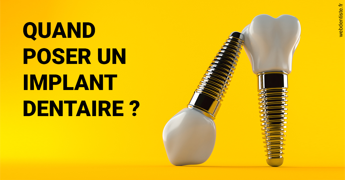 https://www.dentistes-lafontaine-ducrocq.fr/Les implants 2