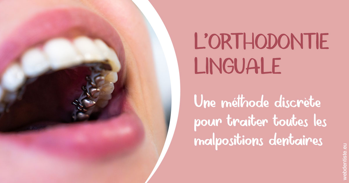 https://www.dentistes-lafontaine-ducrocq.fr/L'orthodontie linguale 2