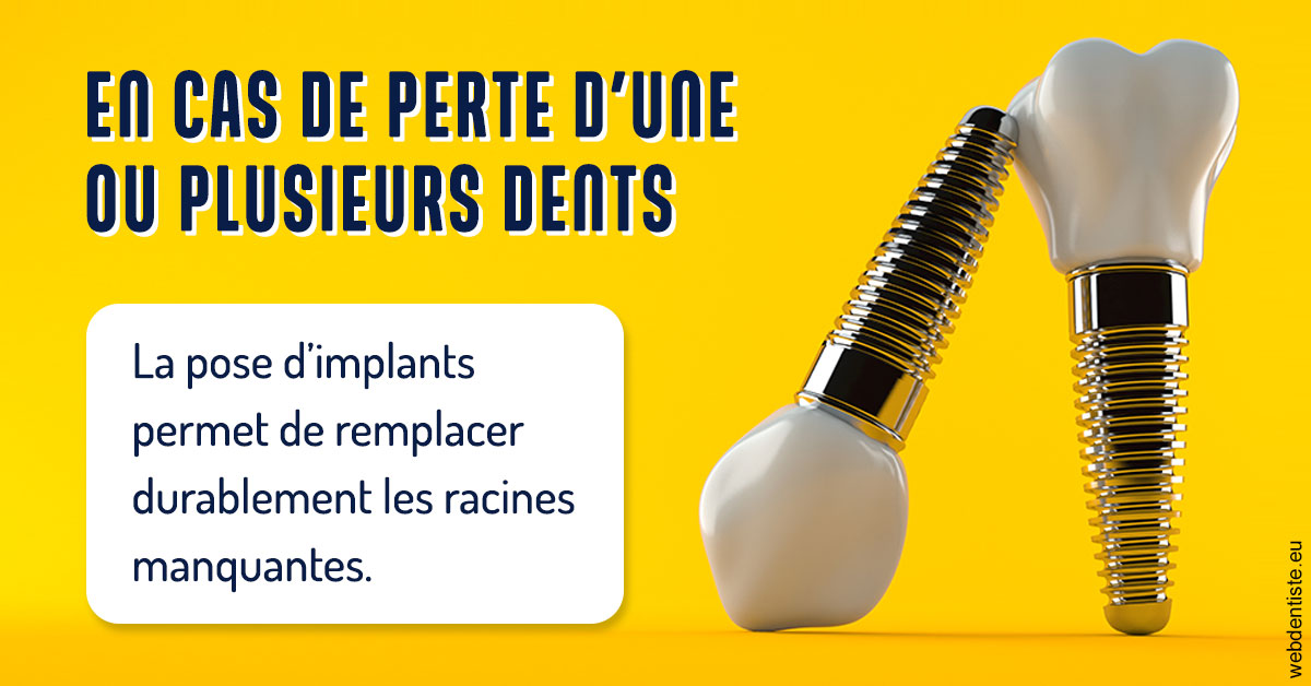 https://www.dentistes-lafontaine-ducrocq.fr/2024 T1 - Implants 02