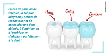 https://www.dentistes-lafontaine-ducrocq.fr/L'INLAY ou l'ONLAY