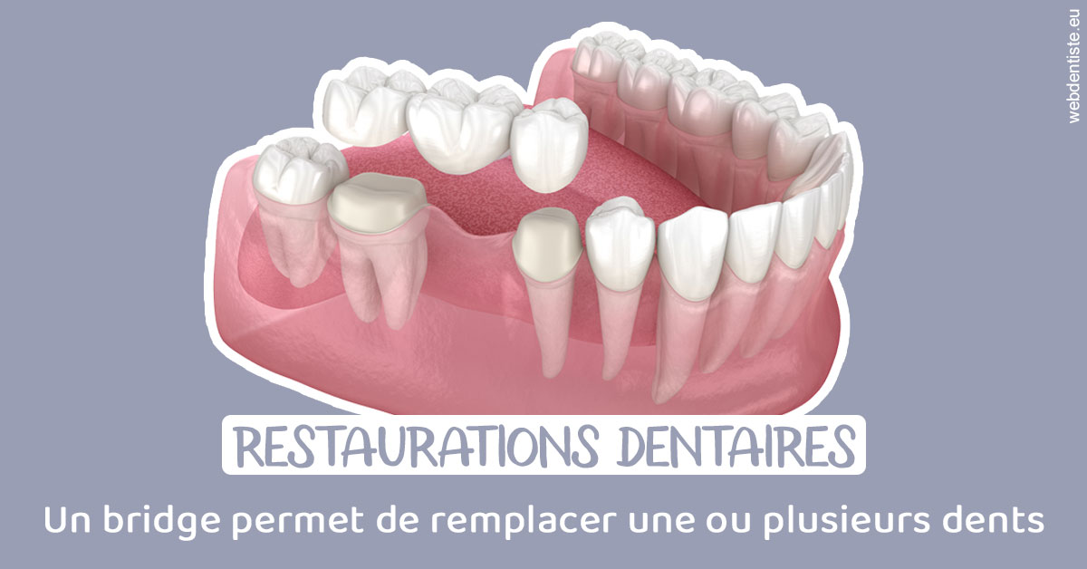 https://www.dentistes-lafontaine-ducrocq.fr/Bridge remplacer dents 1