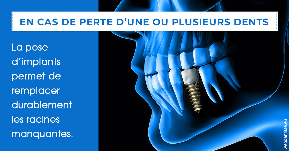 https://www.dentistes-lafontaine-ducrocq.fr/2024 T1 - Implants 01