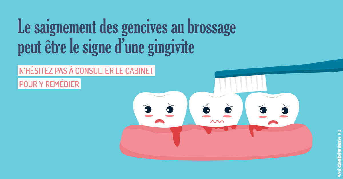 https://www.dentistes-lafontaine-ducrocq.fr/Saignement gencives 2