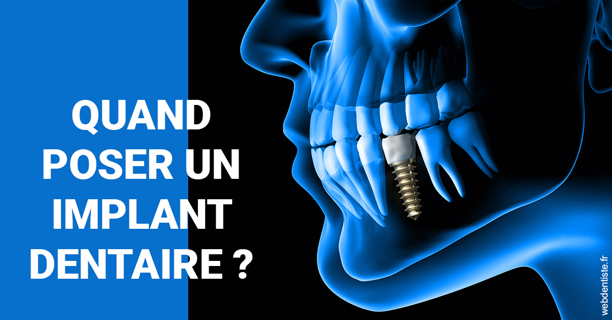 https://www.dentistes-lafontaine-ducrocq.fr/Les implants 1