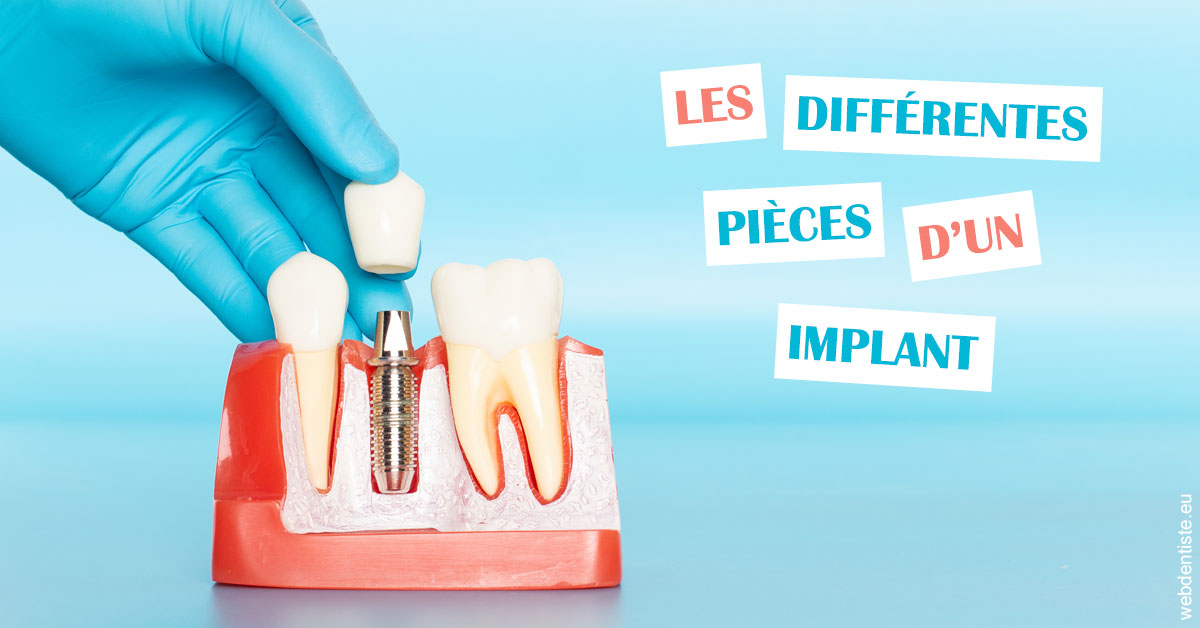 https://www.dentistes-lafontaine-ducrocq.fr/Les différentes pièces d’un implant 2