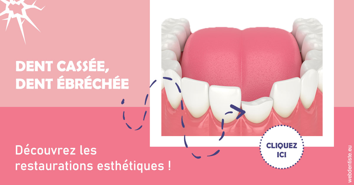 https://www.dentistes-lafontaine-ducrocq.fr/Dent cassée ébréchée 1