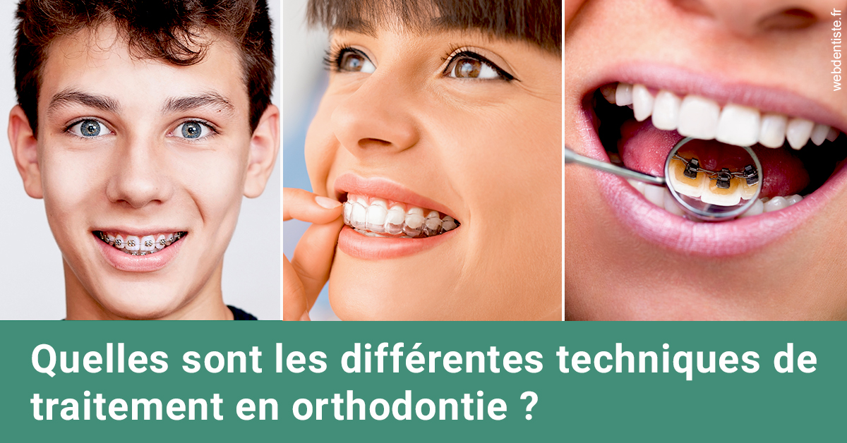 https://www.dentistes-lafontaine-ducrocq.fr/Les différentes techniques de traitement 2
