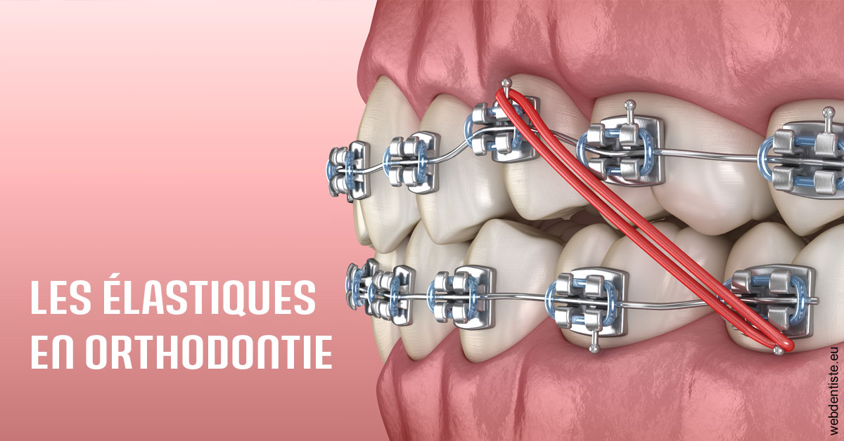 https://www.dentistes-lafontaine-ducrocq.fr/Elastiques orthodontie 2