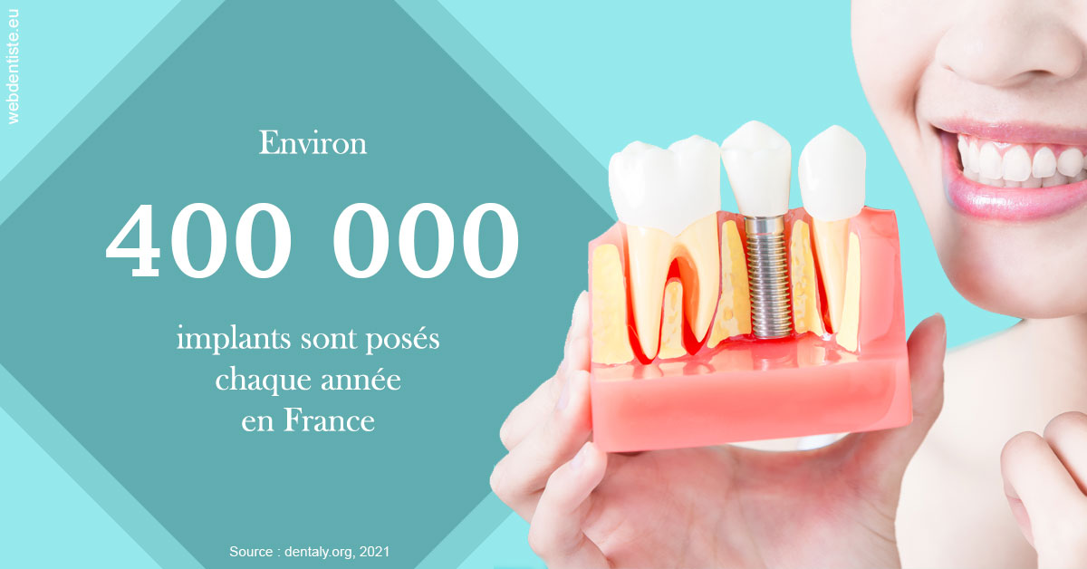 https://www.dentistes-lafontaine-ducrocq.fr/Pose d'implants en France 2