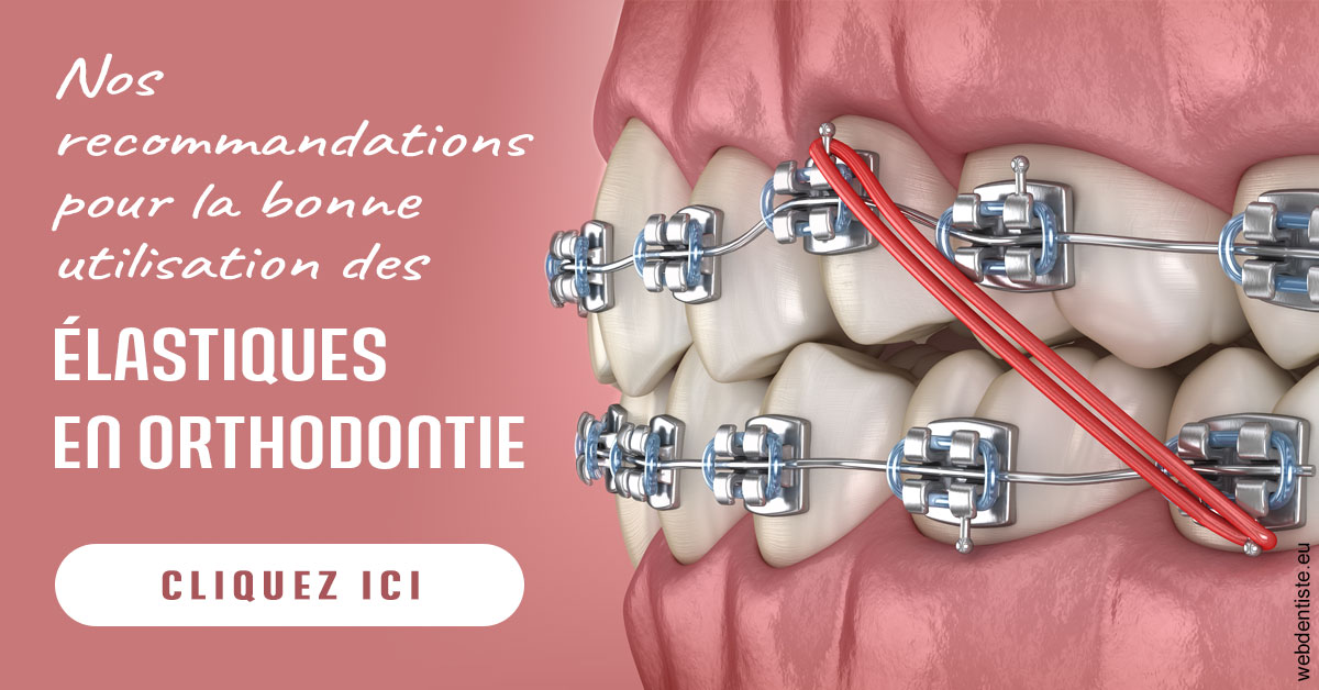 https://www.dentistes-lafontaine-ducrocq.fr/Elastiques orthodontie 2