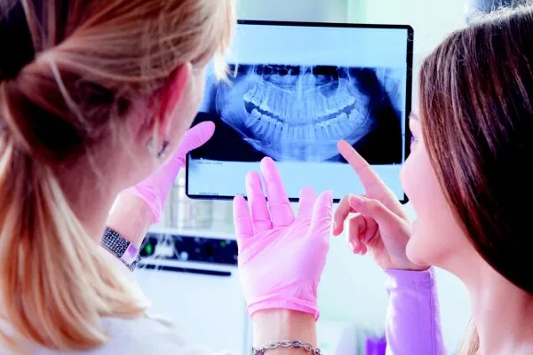 Qu’est-ce qu’un implant ? Indications et contre-indications